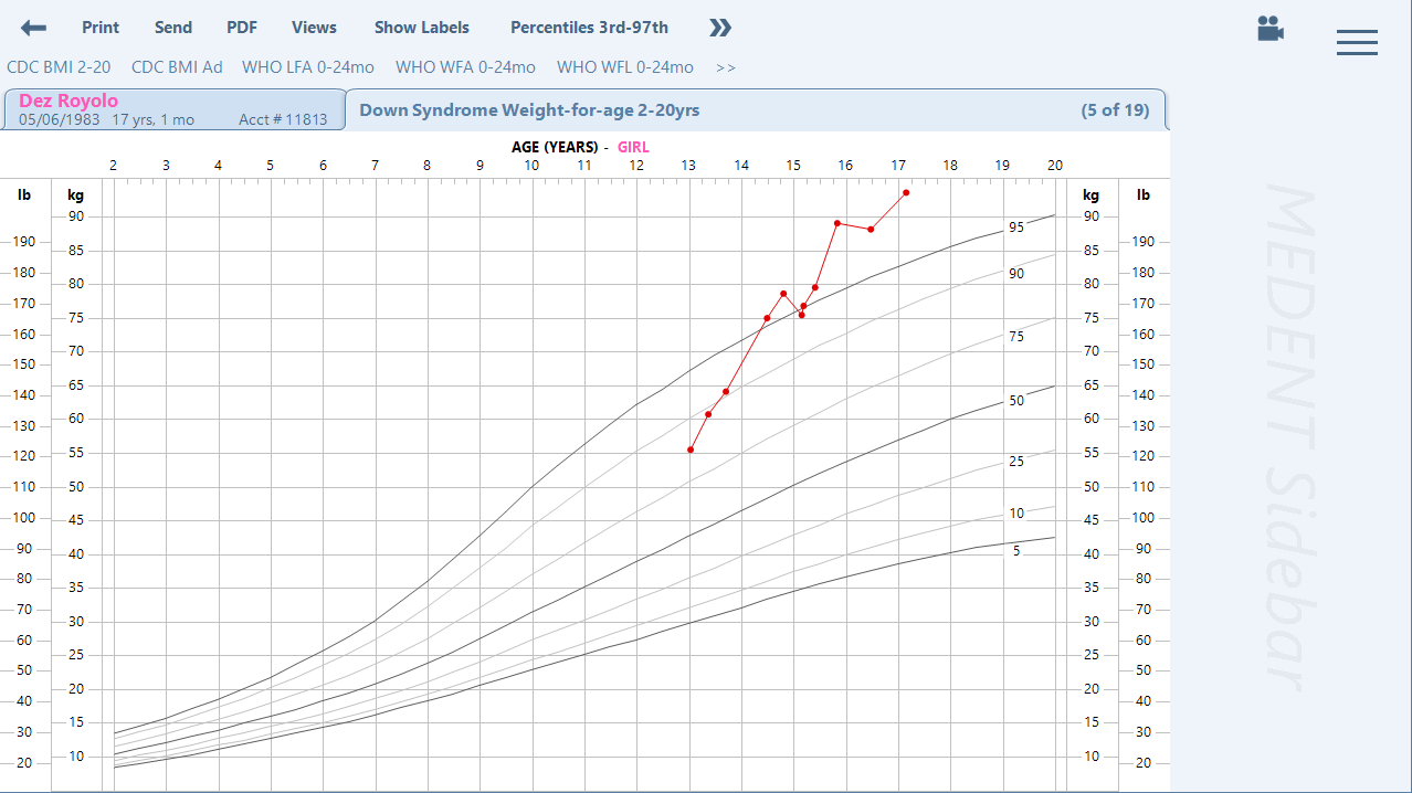 Down Syndrome Growth Chart